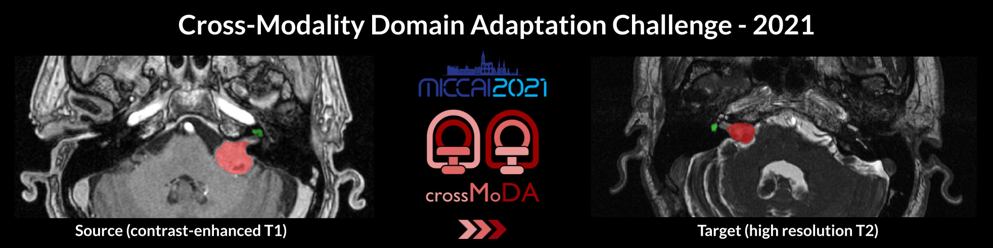Cross-Modality Domain Adaptation for Medical Image Segmentation Banner