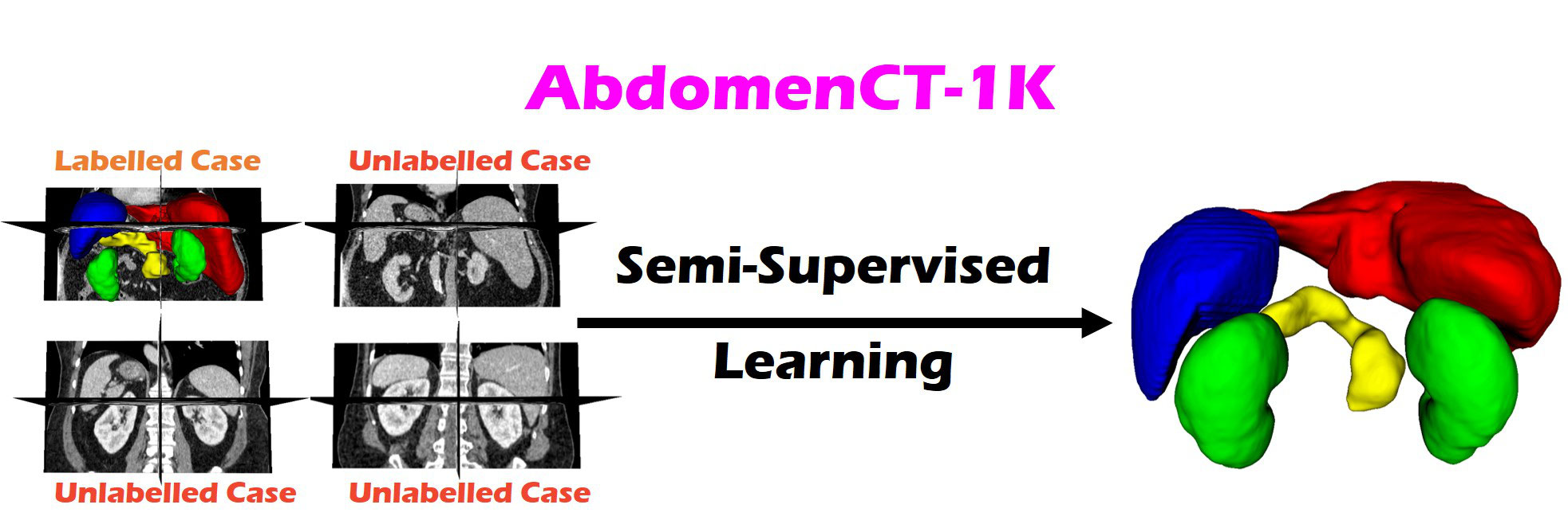 AbdomenCT-1K-Semi-supervised-Learning Banner