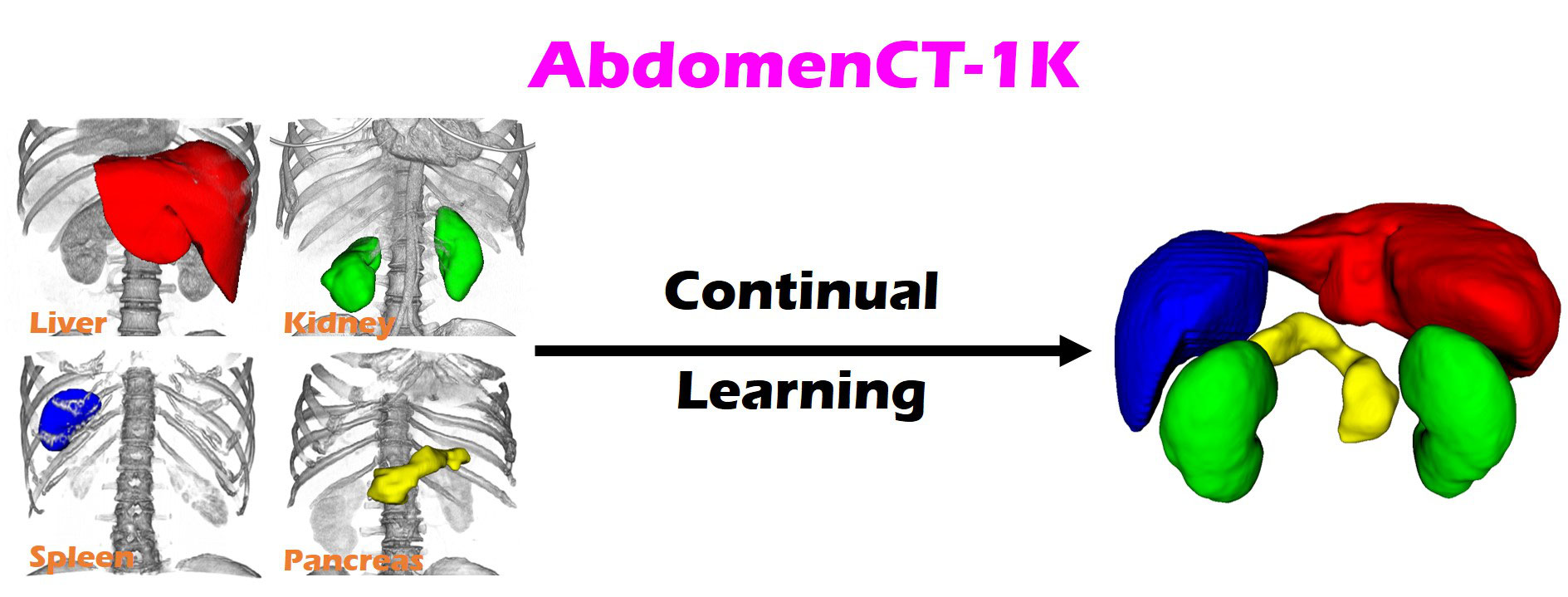 AbdomenCT-1K: Continual Learning Banner