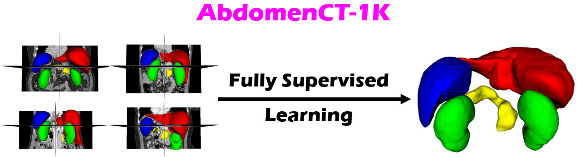 AbdomenCT-1K: Fully Supervised Learning Banner