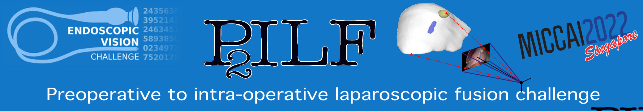 Preoperative to Intraoperative Laparoscopy Fusion Banner