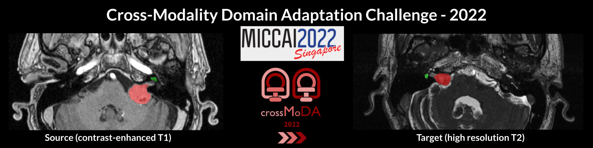 Cross-Modality Domain Adaptation: Segmentation & Classification Banner
