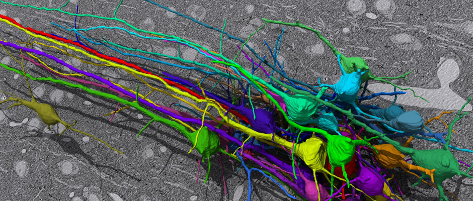 SNEMI3D: 3D Segmentation of neurites in EM images Banner