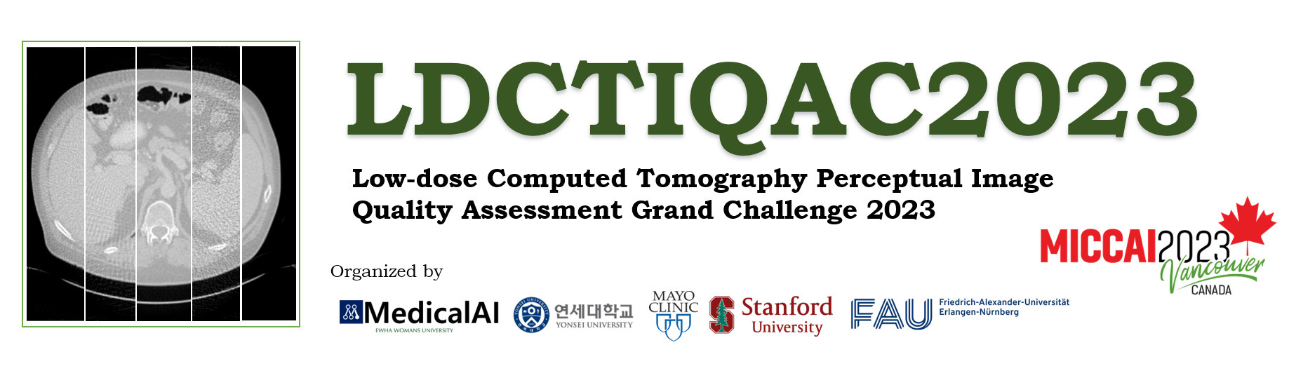 Low-dose Computed Tomography Perceptual Image Quality Assessment Banner