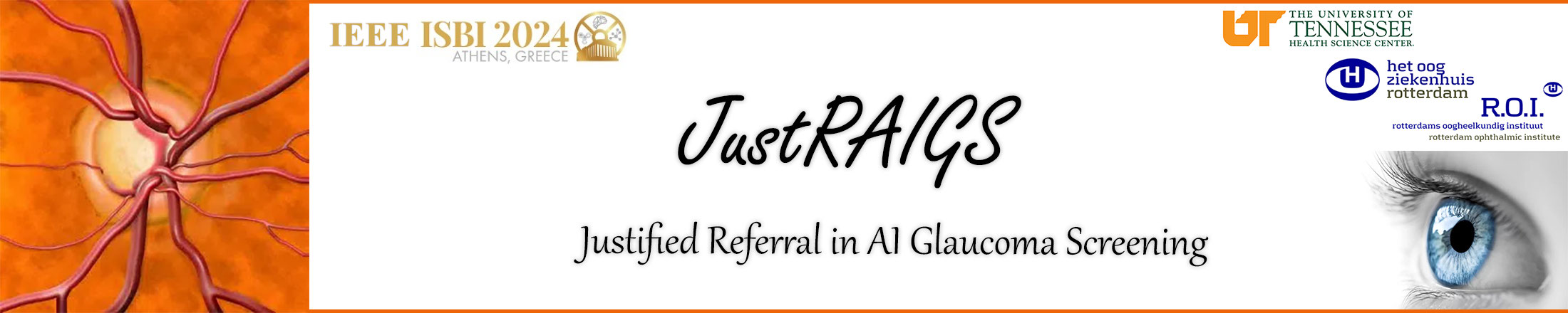 Justified Referral in AI Glaucoma Screening Banner