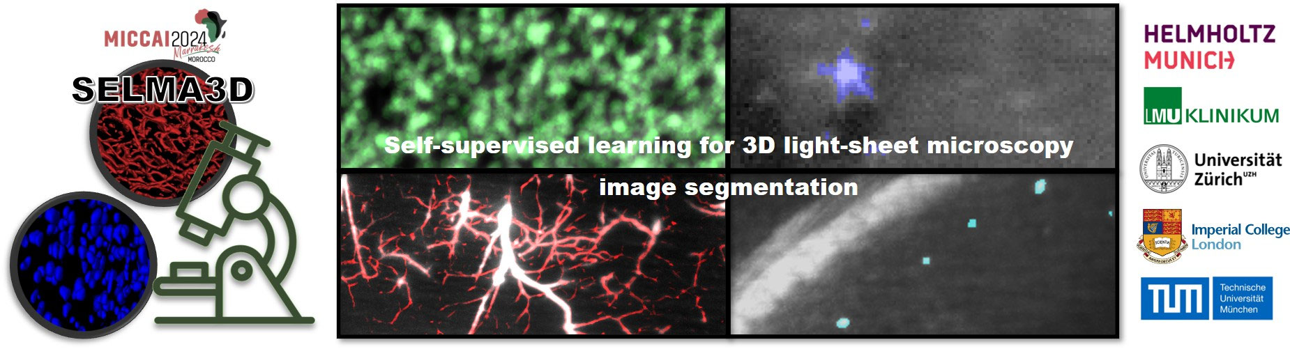 Self-supervised learning for 3D light-sheet microscopy image seg Banner