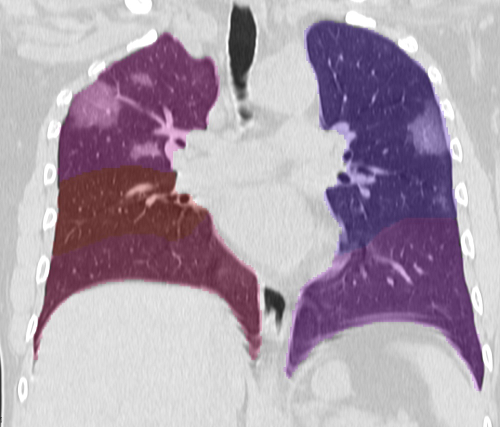Logo for Pulmonary Lobe Segmentation