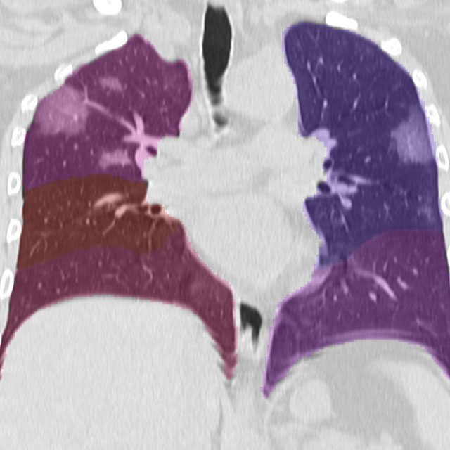 Pulmonary Lobe Segmentation Logo