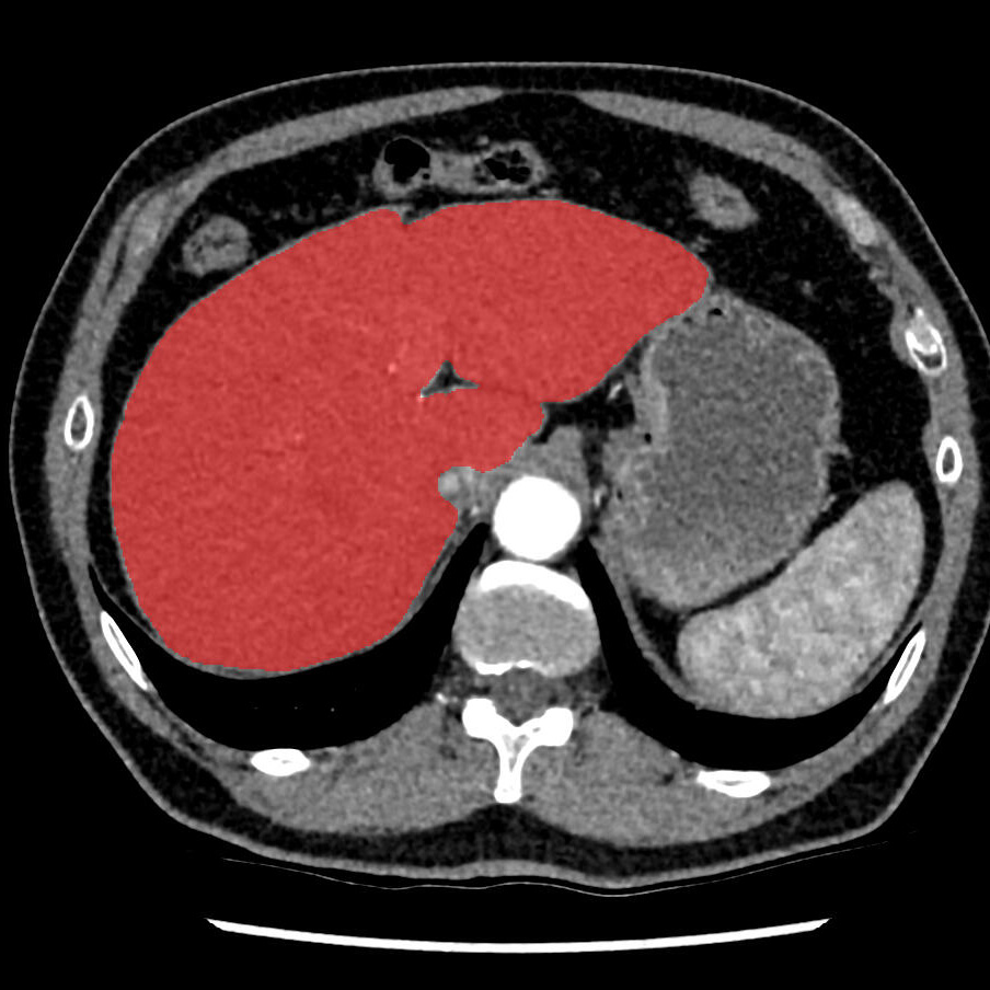 Logo for Liver segmentation