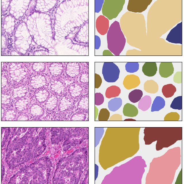 Neural ODEs for Segmentation of Colon Glands Logo