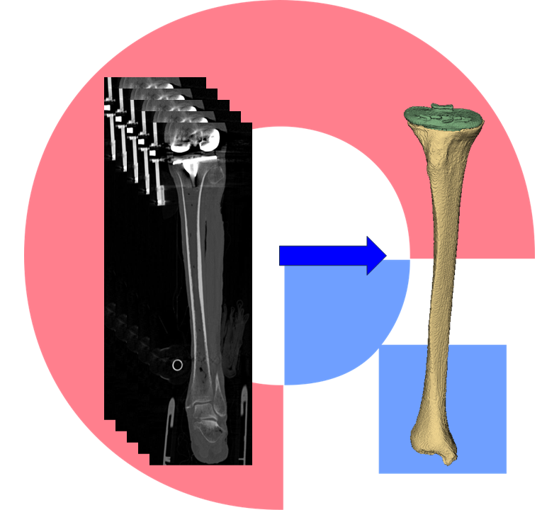 Logo for Tibia bone and implant segmentation