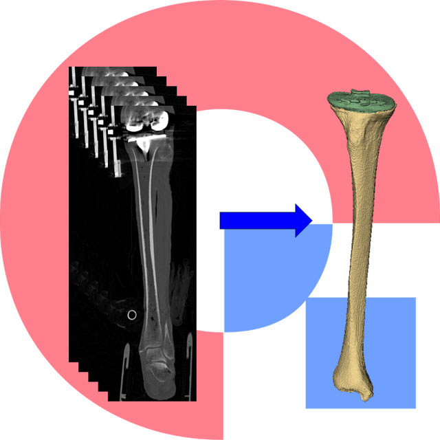 Tibia bone and implant segmentation Logo