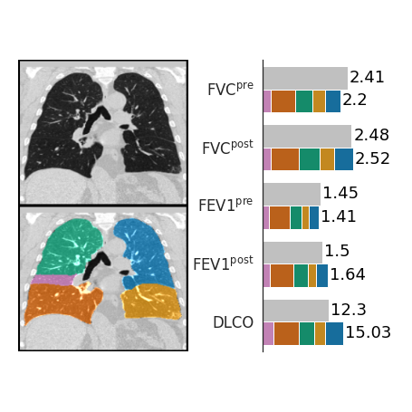 Logo for Lobe-Wise Lung Function Estimation from CT