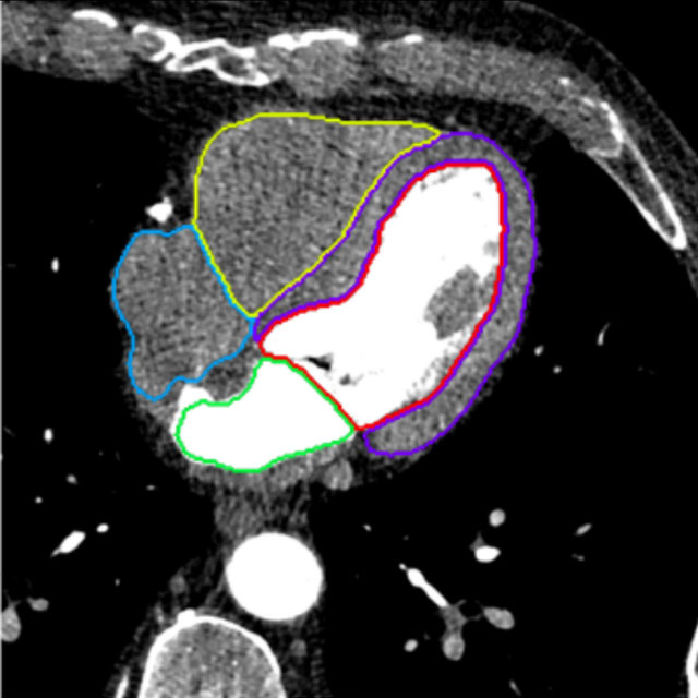 Whole-heart segmentation in 3D contrast-enhanced cardiac CT Logo