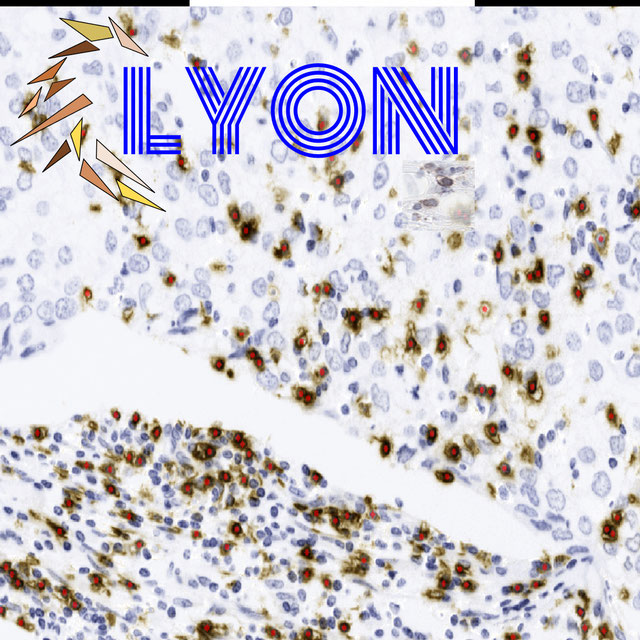 LYON19 Logo