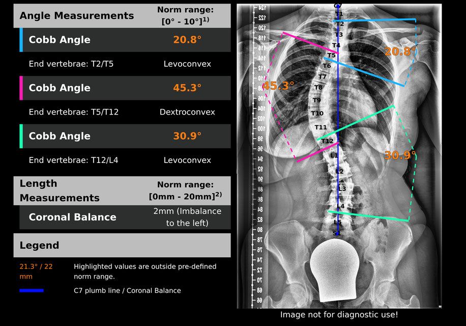 What's up in AI for Radiology - August 2023