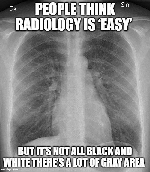 Logo for blog post What's up in AI for Radiology - March 2023