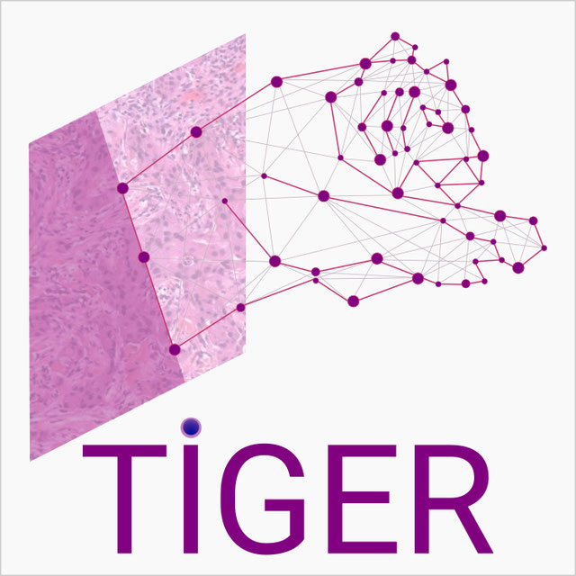 Logo for blog post Can AI predict breast cancer recurrence via automated quantification of tumor-infiltrating lymphocytes?