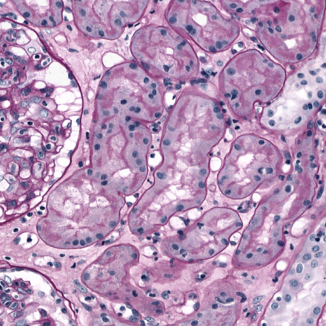 Peritubular capillary segmentation in renal transplant biopsies Logo